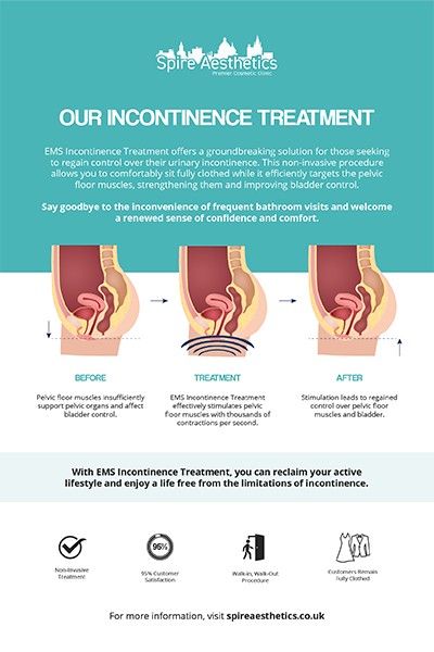image of how urge incontinence Binley treatment works